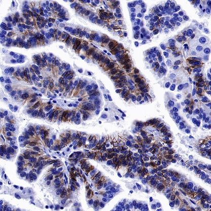 CD56 Recombinant Rabbit mAb (SDT-5000)