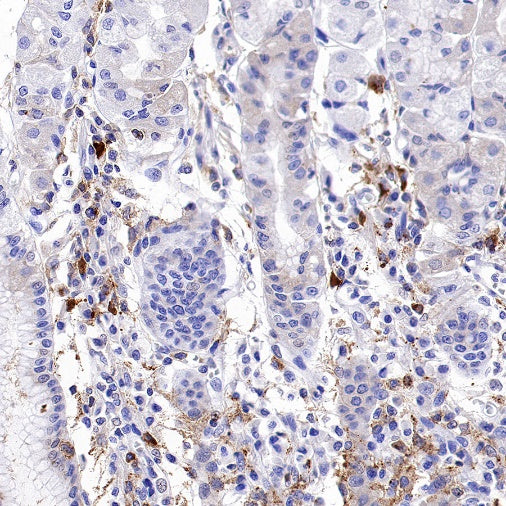 TIM-3 Recombinant Rabbit mAb (S-1450-21)
