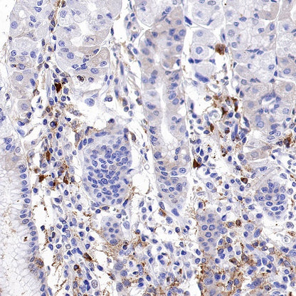 TIM-3 Recombinant Rabbit mAb (S-1450-21)