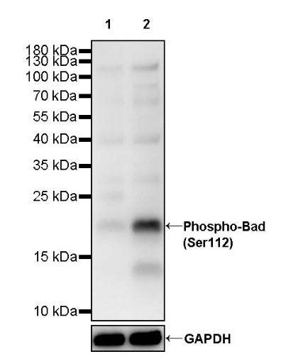 Phospho-Bad (Ser112) Recombinant Rabbit mAb (S-3596)