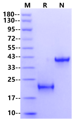 IL-17F Protein, Human