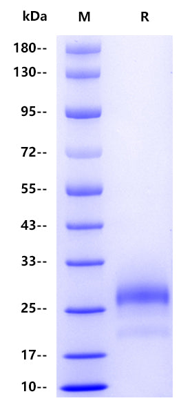 NK1.1/CD161 His Tag Protein, Human