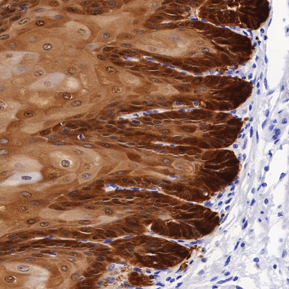 ALDH3A1 Recombinant Rabbit mAb (S-R220)