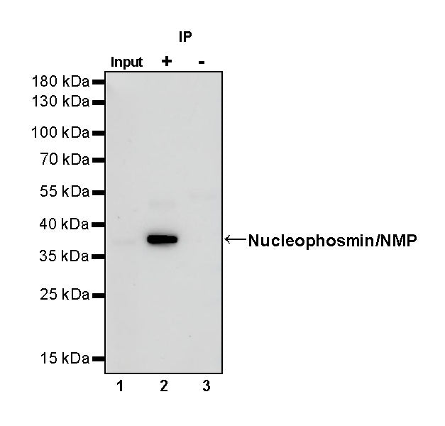 Nucleophosmin/NPM Recombinant Rabbit mAb (S-R231)