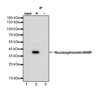 Nucleophosmin/NPM Recombinant Rabbit mAb (S-R231)