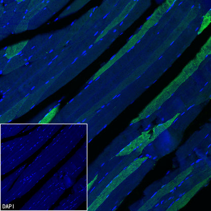 Myoglobin Recombinant Rabbit mAb (S-6197)