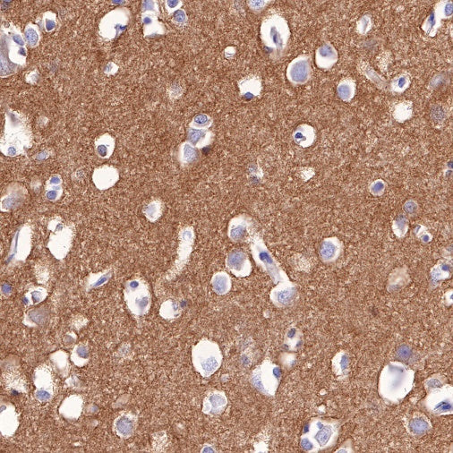 Nectin-1/PVRL1 Recombinant Rabbit mAb (S-279-140)