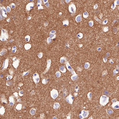 Nectin-1/PVRL1 Recombinant Rabbit mAb (S-279-140)