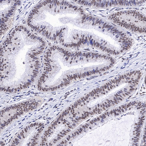 EWSR1/EWS Recombinant Rat mAb (S-R201)