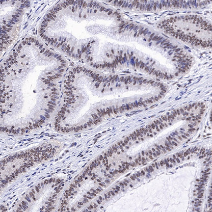EWSR1/EWS Recombinant Rat mAb (S-R201)