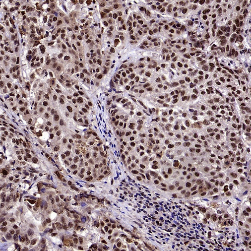 U2AF1 Recombinant Rabbit mAb (S-2384)