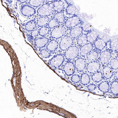 S-RMab® Desmin Recombinant Rabbit mAb (SDT-109-114)