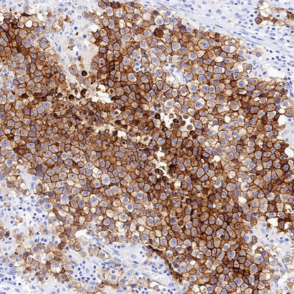 ALPP/ALPPL2 Recombinant Rabbit mAb, PBS Only (SDT-2088-32)
