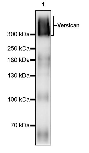 Versican Recombinant Rabbit mAb (S-3770-43)