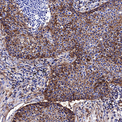 CD99 Recombinant Rabbit mAb (SDT-R122)