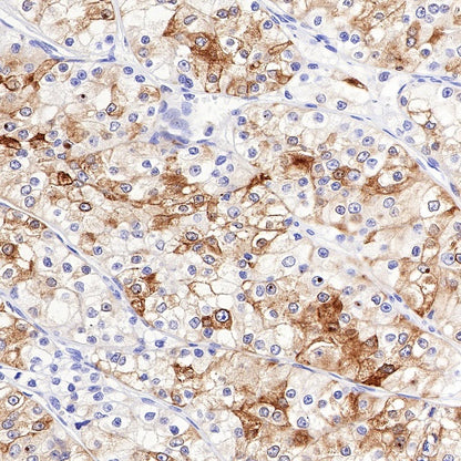 COX2 Recombinant Rabbit mAb (SDT-380-259)