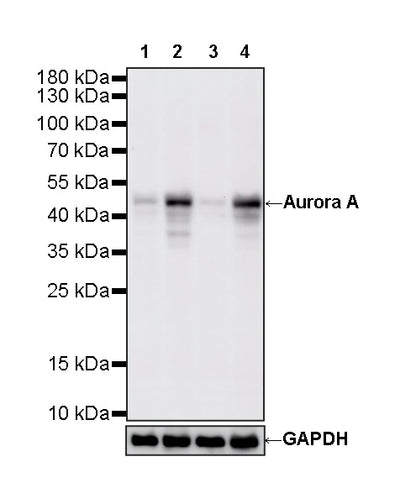 Aurora A Recombinant Rabbit mAb (S-5355)