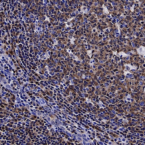 TFEB Recombinant Rabbit mAb,PBS Only (SDT-2411-7)