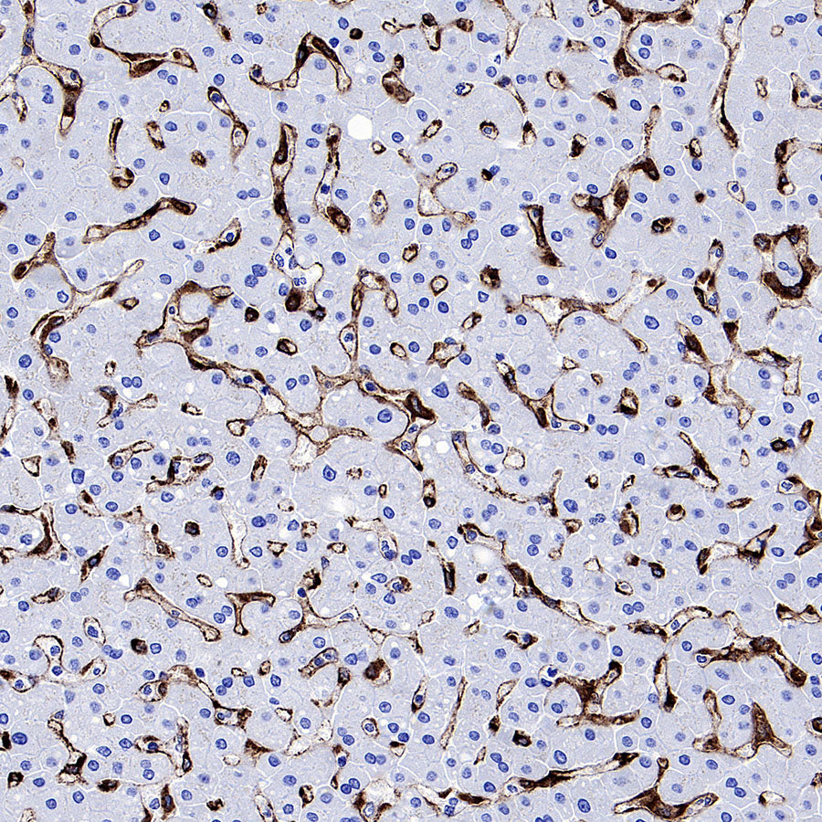CD206 Recombinant Rabbit mAb (S-3477-27)