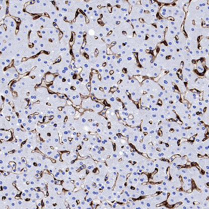 CD206 Recombinant Rabbit mAb (S-3477-27)