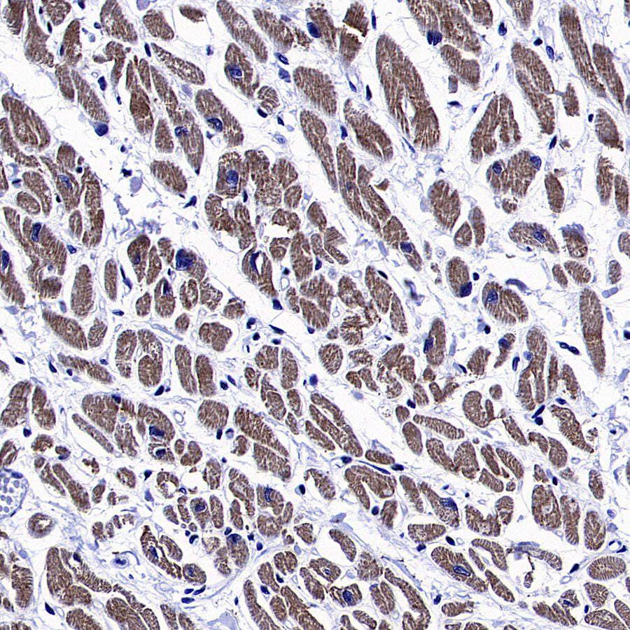 MYH7 Recombinant Rabbit mAb (S-4468-32)
