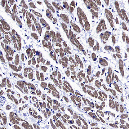 MYH7 Recombinant Rabbit mAb (S-4468-32)
