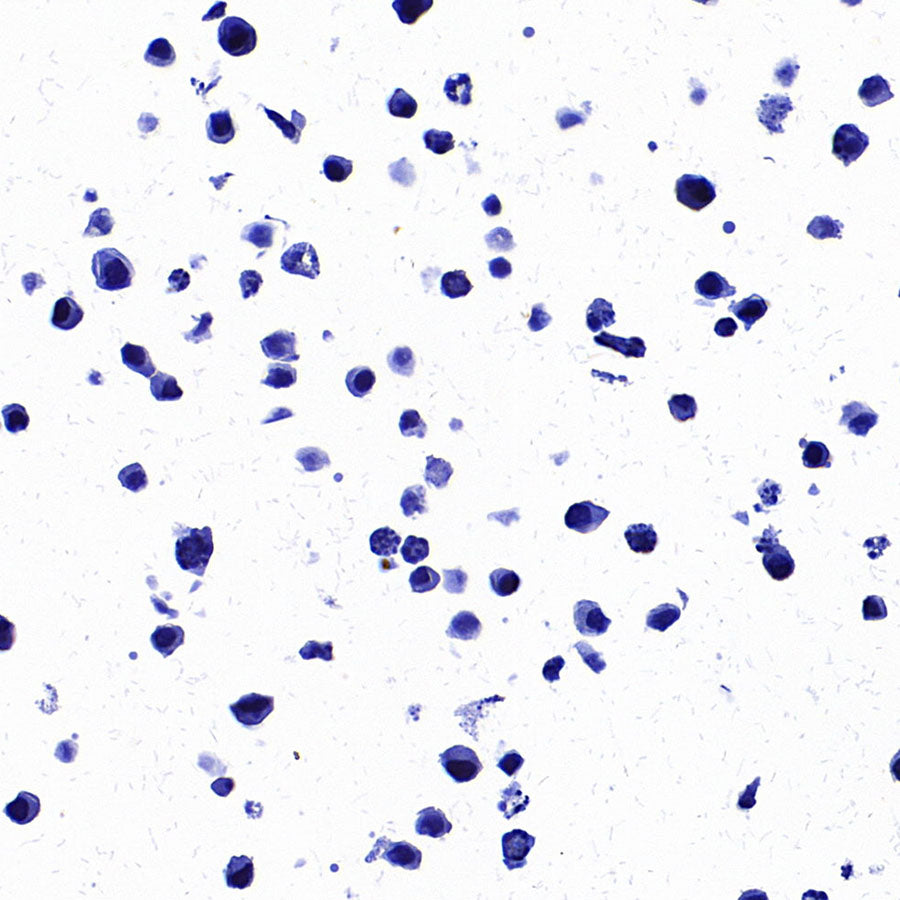 STEAP1 Recombinant Rabbit mAb (S-3613-107)