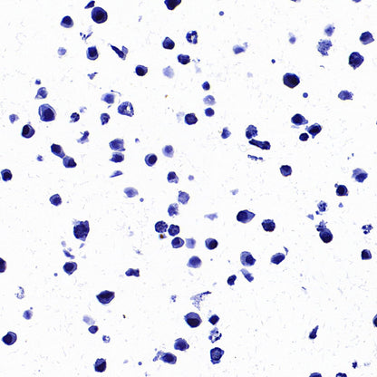 STEAP1 Recombinant Rabbit mAb (S-3613-107)