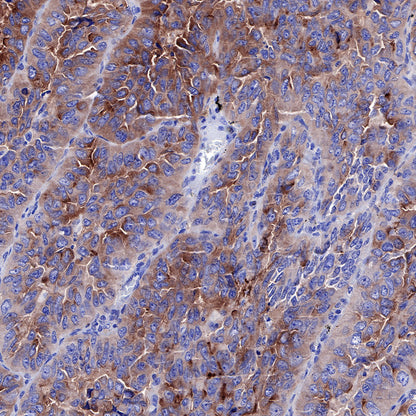 S-RMab® Mesothelin Recombinant Rabbit mAb (SDT-R070)