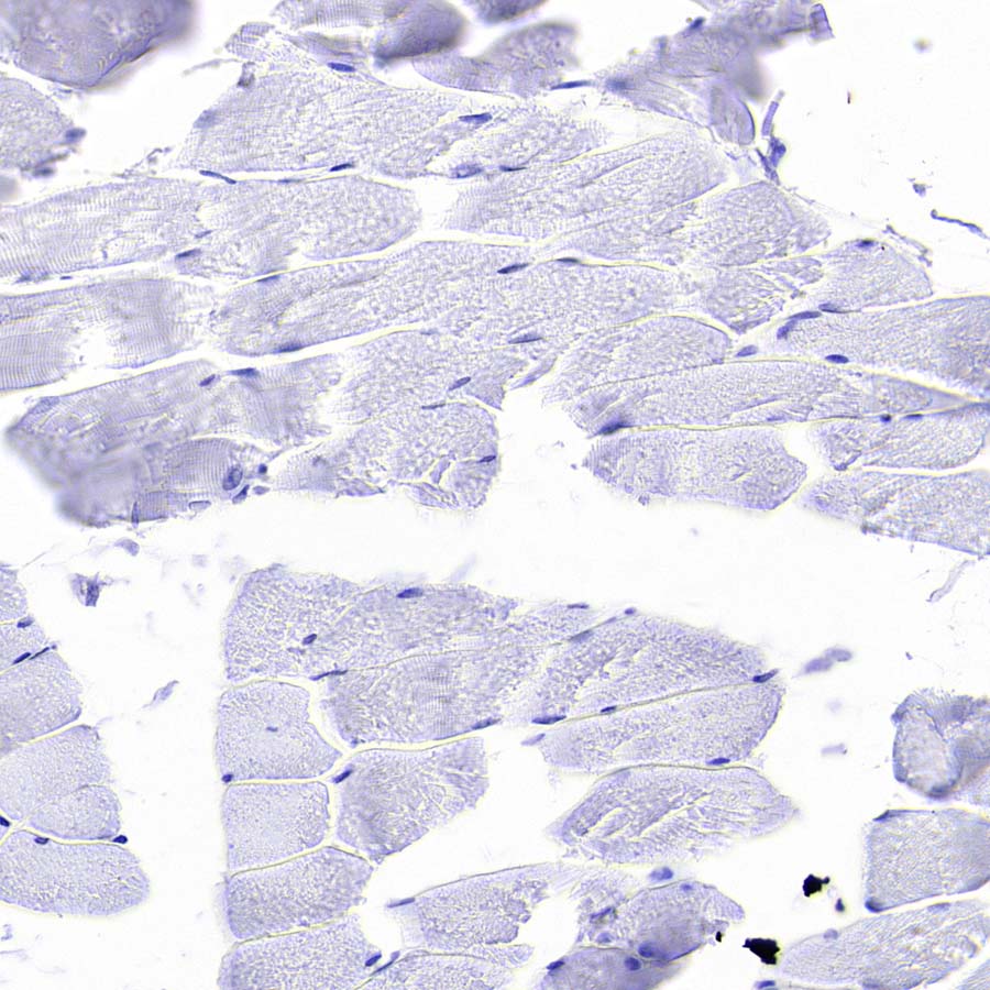 Pklr Recombinant Rabbit mAb (S-4114-40)