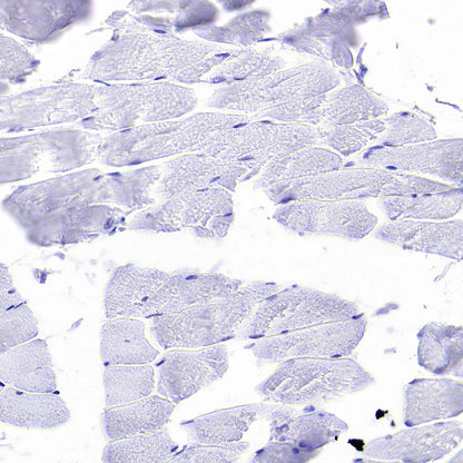 Pklr Recombinant Rabbit mAb (S-4114-40)