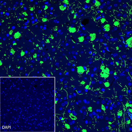 Myelin Basic Protein Recombinant Rabbit mAb (S-582-79)