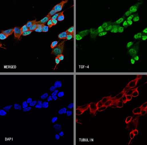 TCF-4 Recombinant Rabbit mAb,PBS Only (SDT-2549-4)