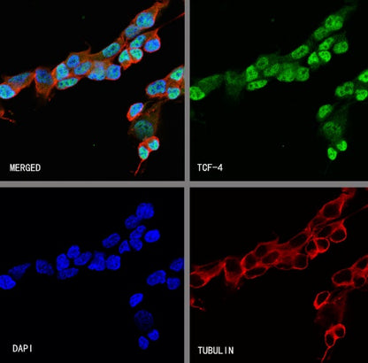TCF-4 Recombinant Rabbit mAb,PBS Only (SDT-2549-4)