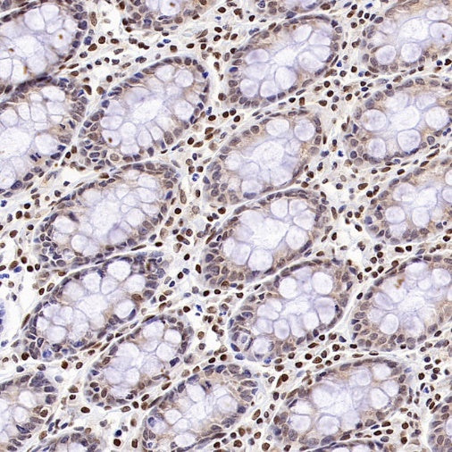 Bmi1 Recombinant Rabbit mAb (S-3313-71)