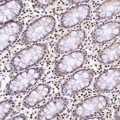 Bmi1 Recombinant Rabbit mAb (S-3313-71)