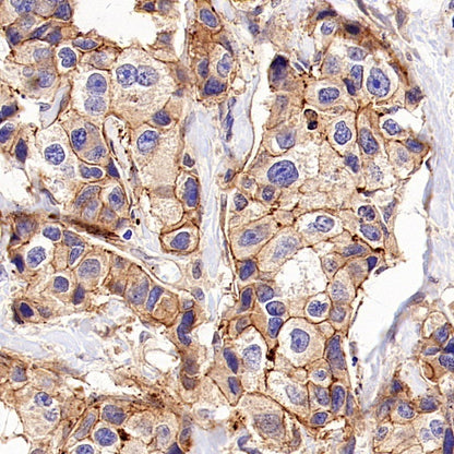 B7-H2/ICOSLG Recombinant Rabbit mAb (S-3306-12)