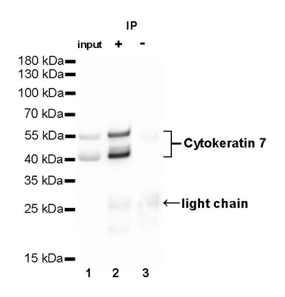 Cytokeratin 7 Recombinant Rabbit mAb (SDT-R028)