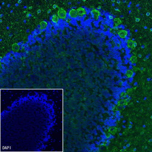 Parvalbumin Recombinant Rabbit mAb (S-1620-10)