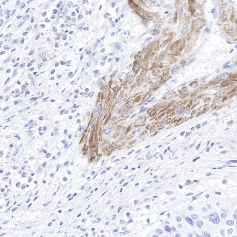 pan (alpha) actin Recombinant Rabbit mAb (SDT-044-17)