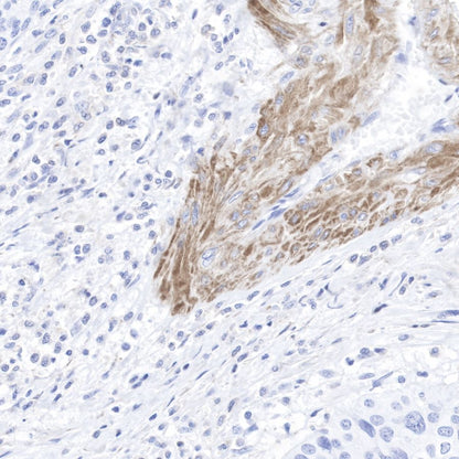 pan (alpha) actin Recombinant Rabbit mAb (SDT-044-17)
