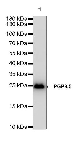 PGP9.5 Recombinant Rabbit mAb (S-R281)