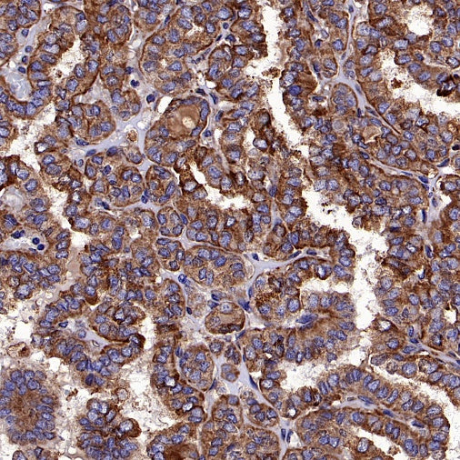 Calnexin Rabbit Polyclonal Antibody