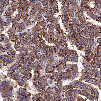 Calnexin Rabbit Polyclonal Antibody