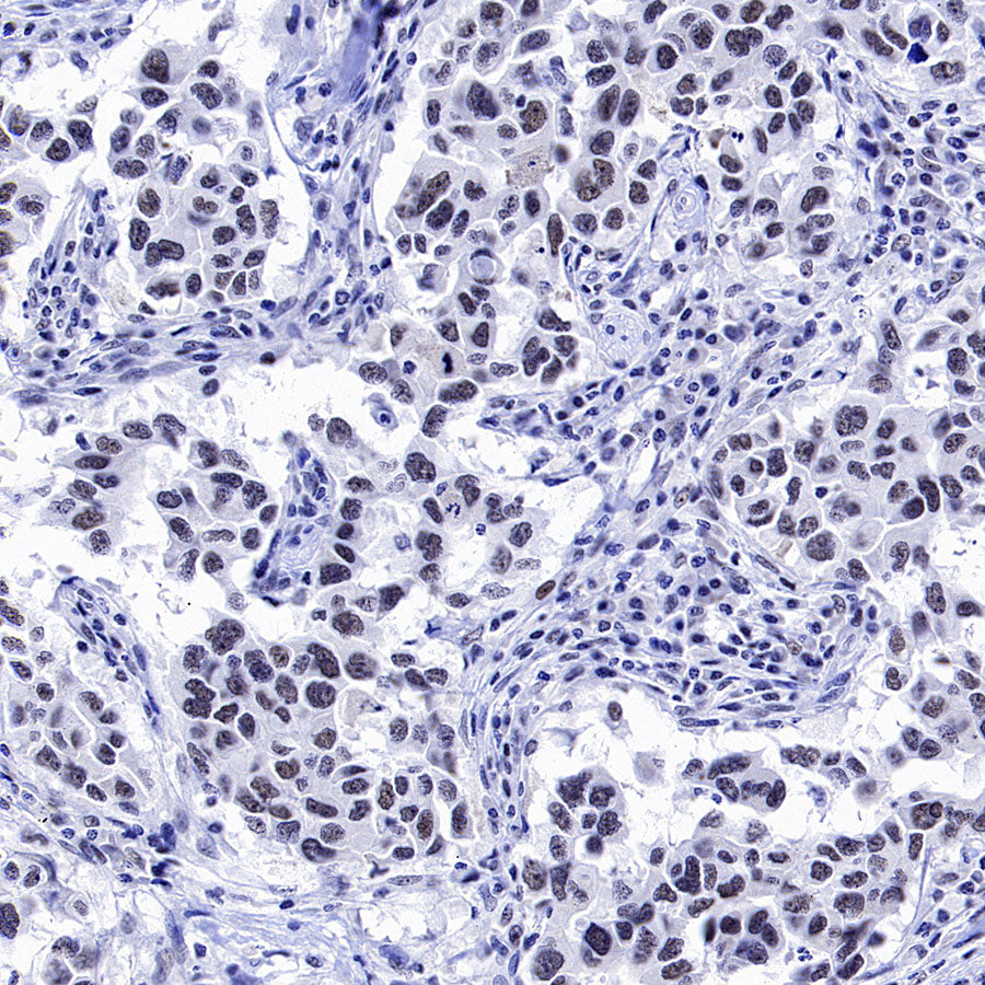 CDK7 Recombinant Rabbit mAb (S-2739-124)