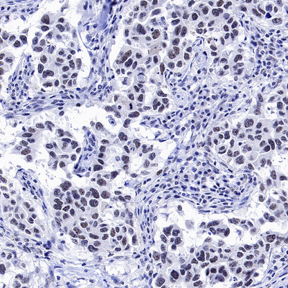 CDK7 Recombinant Rabbit mAb (S-2739-124)
