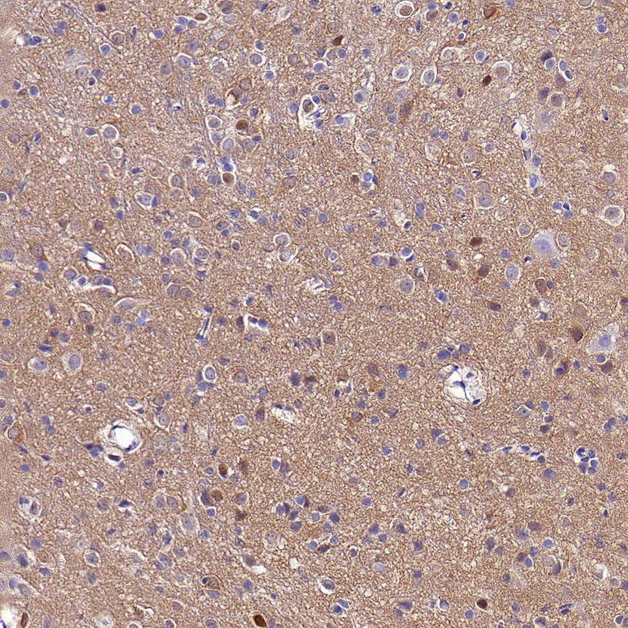 TORC1/CRTC1 Recombinant Rabbit mAb (S-3978-42)