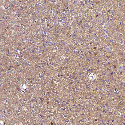TORC1/CRTC1 Recombinant Rabbit mAb (S-3978-42)