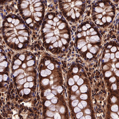 SBDS Recombinant Rabbit mAb (S-R344)