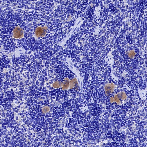 TGF beta 1 Recombinant Rabbit mAb (S-3204)